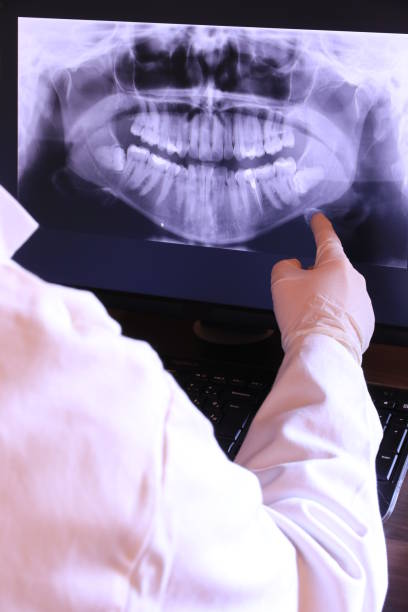 Best Emergency Dental Care for Broken or Chipped Teeth in Stryker, OH